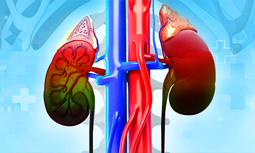 Chronic-Kidney-Disease