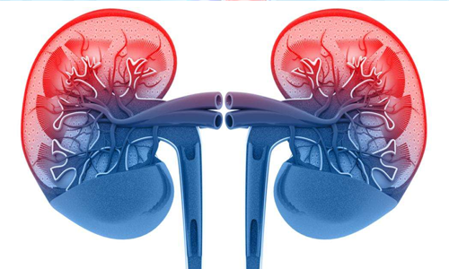 Acute-Kidney-Injury