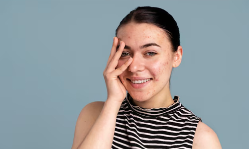 Skin-issues
