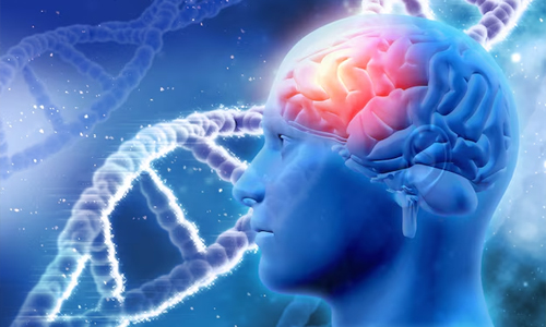 What-Causes-Silent-Migraine