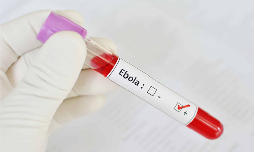 Diagnosis-&-Tests-for-Ebola-Virus-Disease