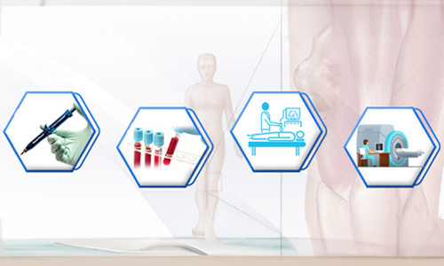 Diagnosis of Sarcoma Cancer
