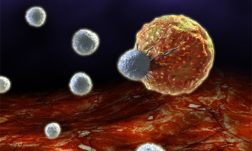 Immune-System-Dysfunction