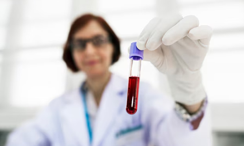 Tests-and-Procedures