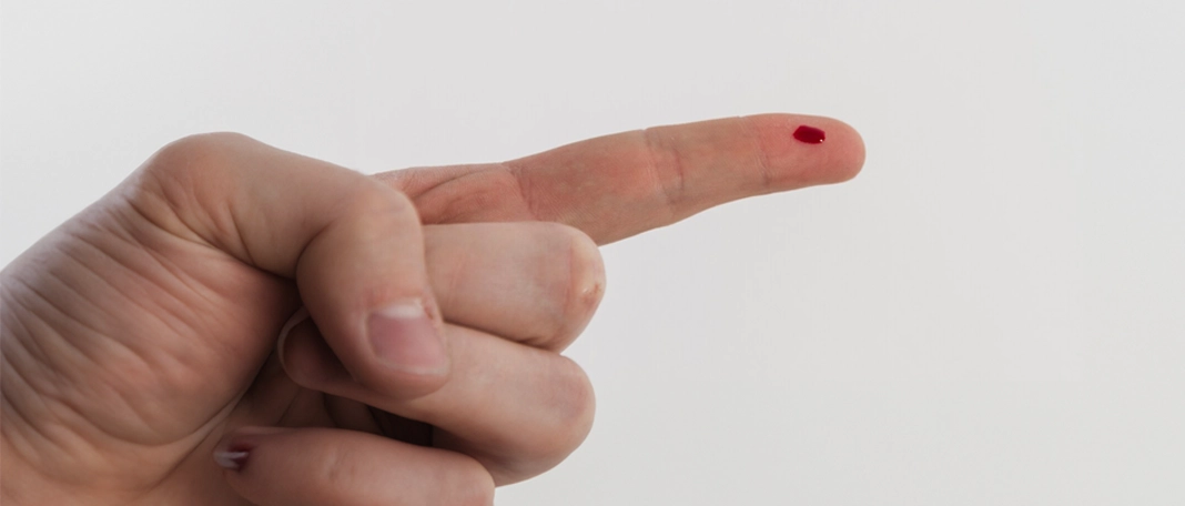 Everyday Cuts and Scrapes: How to Heal Cuts Fast & Minimize Scars