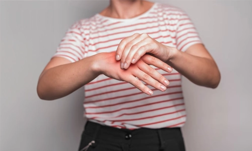 Natural Remedies for Cuts and Scrapes