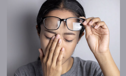 Eye Issues