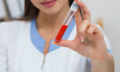 How-Do-I-Lower-My-A1C-Level