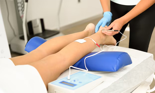 Laser Treatment