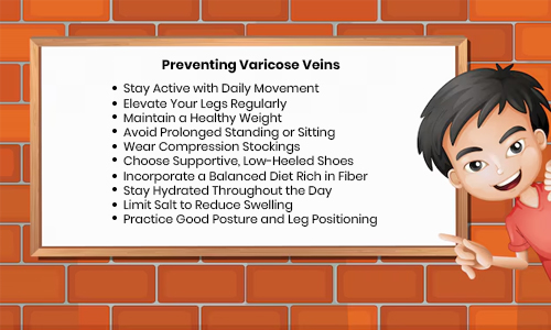 Preventing Varicose Veins