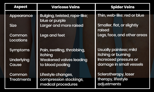 Varicose Veins Vs Spider Veins