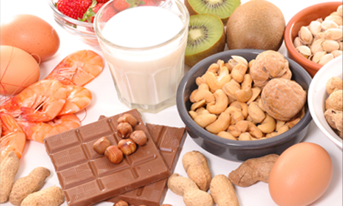 Food allergy