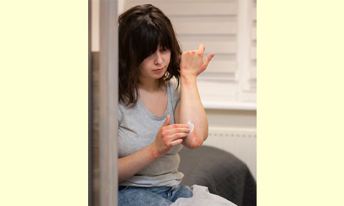 Other Allergic Reactions