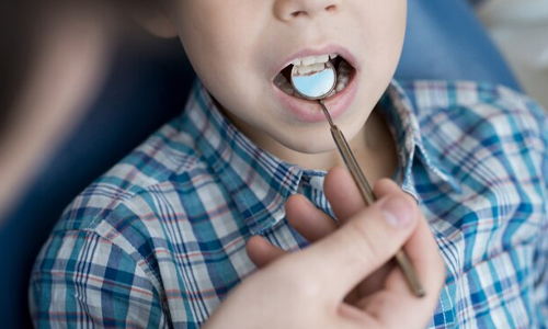 Getting Dental checkups