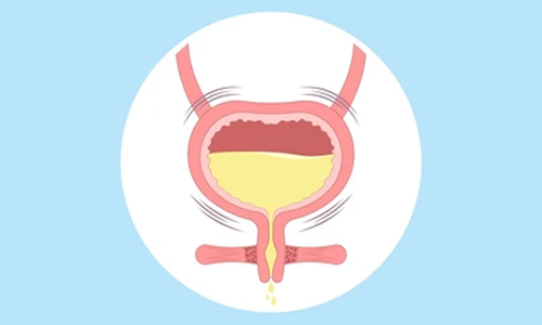 What-is-an-Overactive-Bladder
