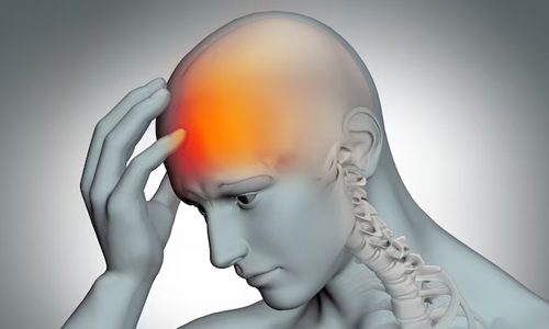 The Causes of Brain Herniation