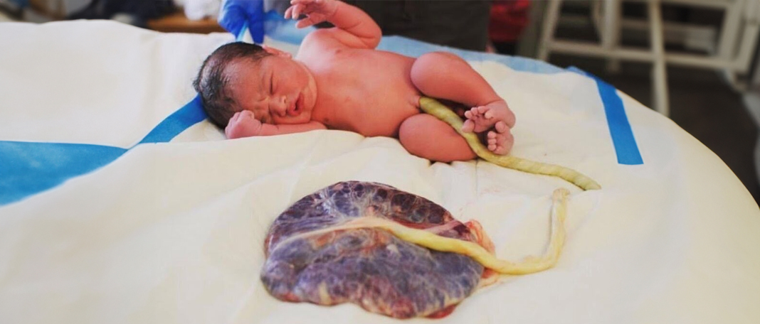 Lotus Birth: How It Works, Benefits, Risks, and Other Considerations