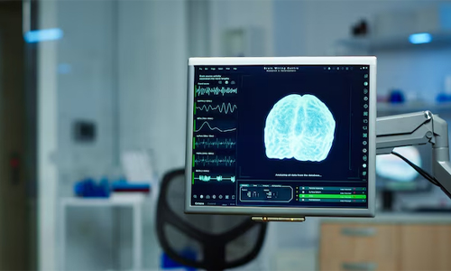 Brain Herniation Diagnosed