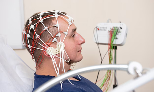 Brain Herniation Treatment