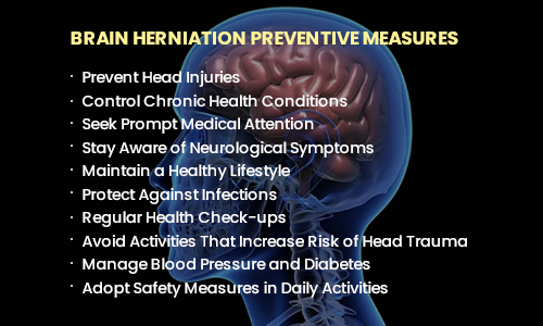 Brain Herniation preventive measures