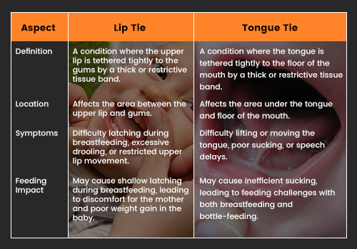 Differences-Between-Lip-Tie-and-Tongue-Tie
