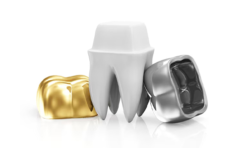 Sliver crown for teeth