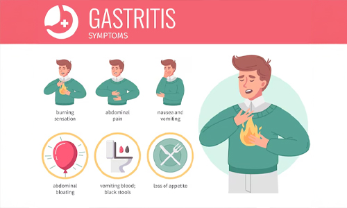 GERD-symptoms