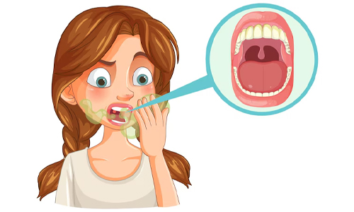 About Gingivitis