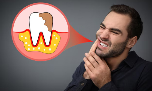 Inconsistent oral hygiene