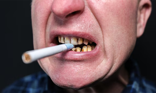 smoking and tobacco