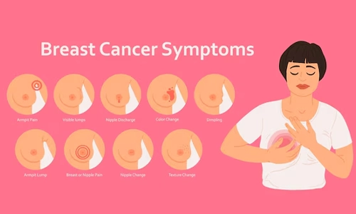 Breast cancer symptoms and early detection infographic