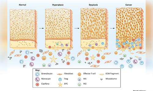 What-Are-Precancerous-Cells