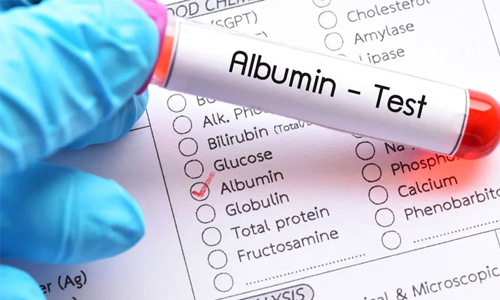 Factors That Influence Albumin Function