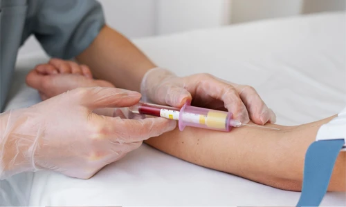 Healthcare professional drawing blood from a patient for a quantitative hCG pregnancy blood test.