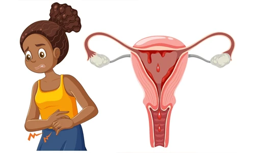 Illustration of a woman experiencing sharp abdominal pain, representing medical signs of an ectopic pregnancy.