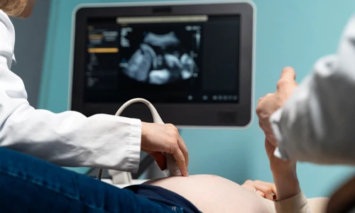 Gynecologist performing an ultrasound scan during a first-trimester prenatal consultation.