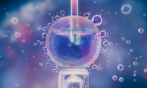 3D medical rendering illustrating the process of intrauterine insemination (IUI) for fertility treatment.