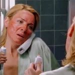 Chemical Peels: Myths, Benefits, Types & What to Expect