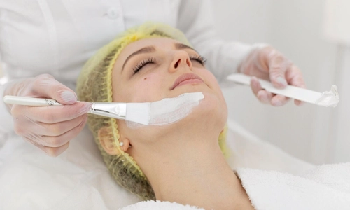 Benefits of Chemical Peels