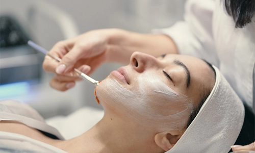 Chemical Peels