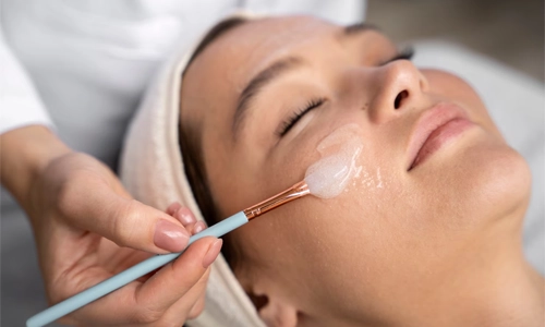 5 Myths About Chemical Peels