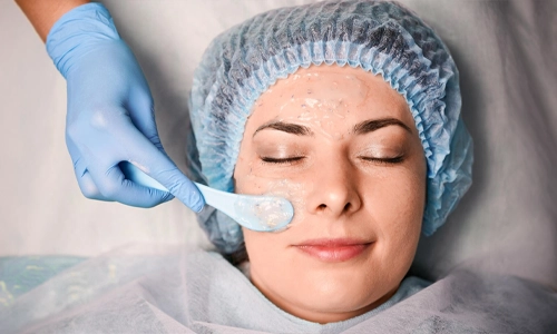 Popular Chemical Peel Formulations Explained