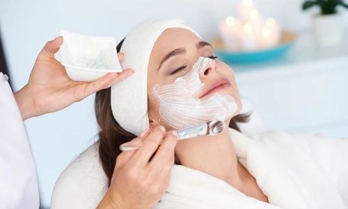 Chemical Peels Before and After